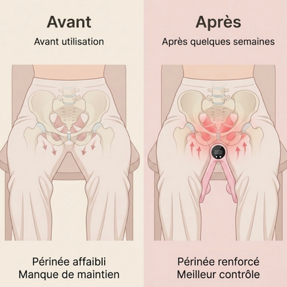 Dites stop aux fuites. En seulement 10 minutes par jour.