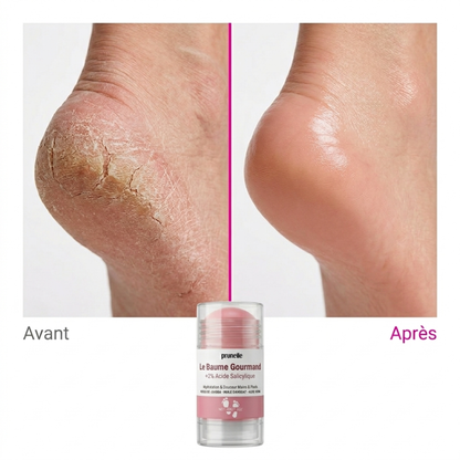 Le Baume Gourmand : Pieds doux et hydratés