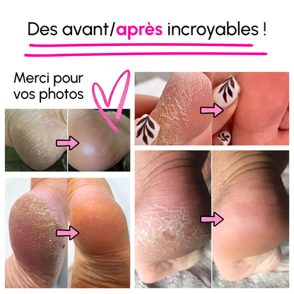 Prunelle Pro